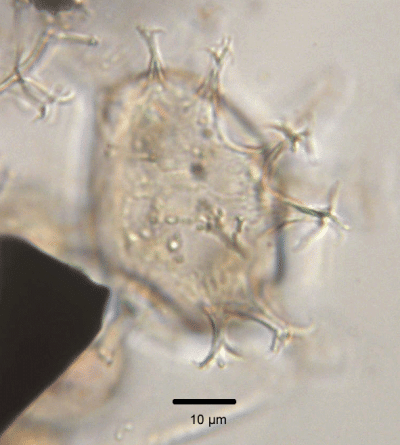 S.lazus ventral view