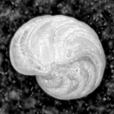 Morphometry