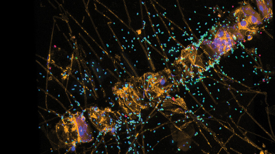 Polysaccharid-abbauende Bakterien (grün) an der Diatomee (Kieselalge) Chaetoceros sp. Foto: I. Bakenhus/Max-Planck-Institut für Marine Mikrobiologie, Bremen