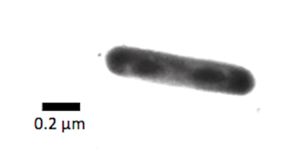 Ammoniak oxidierende Archaeen unter dem Elektronenmikroskop. Foto: MARUM - Zentrum für Marine Umweltwissenschaften, Universität Bremen; M. Könneke