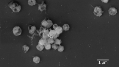Electron micrograph of Lentimonas, the bacteria of this study. The cells are small round cocci and grow as an aggregate. (Photo: Max Planck Institute for Marine Microbiology/A. Sichert)