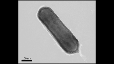 Der Einzeller Nitrosopumilus maritimus kann Sauerstoff produzieren. Das haben Forschende der Universität Oldenburg und der Syddansk Universitet nachgewiesen – erstmals bei einem Organismus aus der Domäne der Archaeen. Foto: Universität Oldenburg