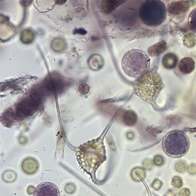Tripos hexacanthus. Foto: MARUM/ Uni Bremen