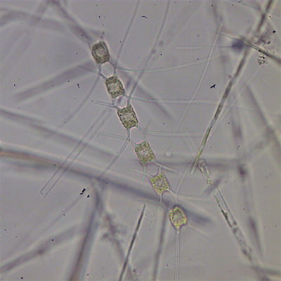 Chaetoceros atlanticus. Foto: MARUM/ Uni Bremen