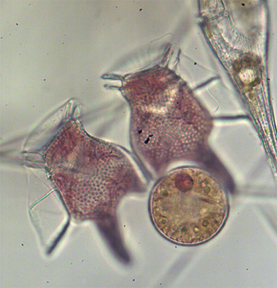 Dinophysis tripos. Foto: MARUM/ Uni Bremen