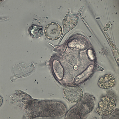 Protoperidinium depressum. Foto: MARUM/ Uni Bremen