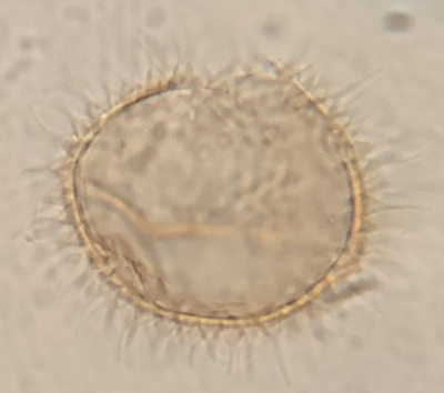 A constrictum cross section