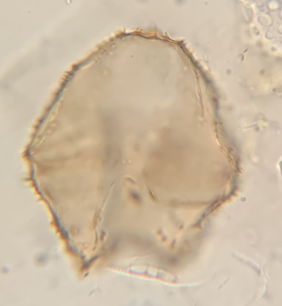 cross section