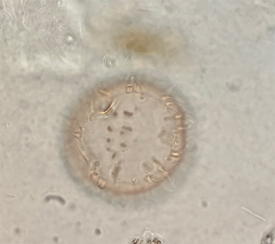 Partikel einer Planktonart, die nährstoffreiche Gewässer "bevorzugt". Foto: K. Zonneveld