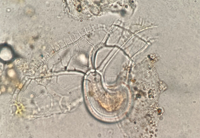 Wunderbare Welt in einem Wassertropfen. (Abgebildete Arten: Histioneis milneri, eine Einzeller, die eine spezielle Kammer hat, um photosynthetische Bakterien zu beherbergen, die diese Art mit die Nahrung versorgen, die sie braucht). Foto: K. Zonneveld