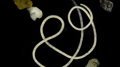 The gutless marine worm Olavius algarvensis under the microscope. It is about two centimeters long and only 0.5 milimeters wide, and lives in between the sand grains (shown on photo) next to seagrass beds in the Mediterranean Sea. Photo: Rebekka Jahnke / Max Planck Institute for Marine Microbiology