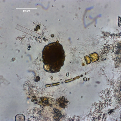 Aggregat marinen "Schnees", Foto: MARUM – Zentrum für Marine Umweltwissenschaften, Universität Bremen; M. Iversen 