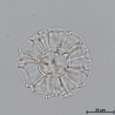 Nematosphaeropsis labyrinthus