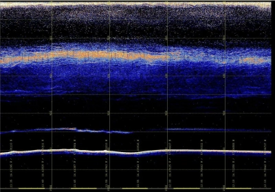 Querschnitt der Wassersäule. Der hellere Teil ist das Plankton.