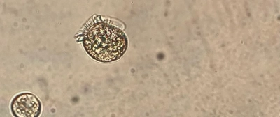 Dinphysis