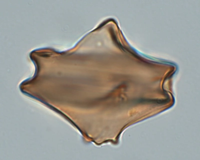 Cyst of Protoperidinium subinerme