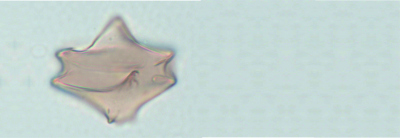 Protoperidnium subinerme