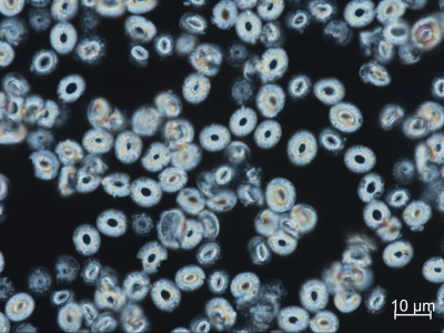 Coccolithophoren bilden Kalzitplättchen als eine Art Exoskellett. Sterben die Organismen, sinken sie in Plättchen mit den gespeicherten geochemischen Signaturen ihrer Lebenszeit vom oberen Ozean in die Tiefsee und lagern sich Schicht um Schicht am Ozeanboden ab. Foto: Luz María Mejía 