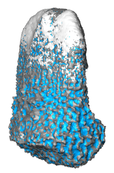 Visualisation of microstructures and intrpores of an ophiuroid tooth
