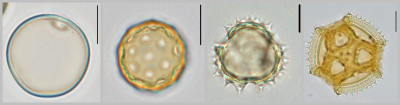 Pollen - optical microscope